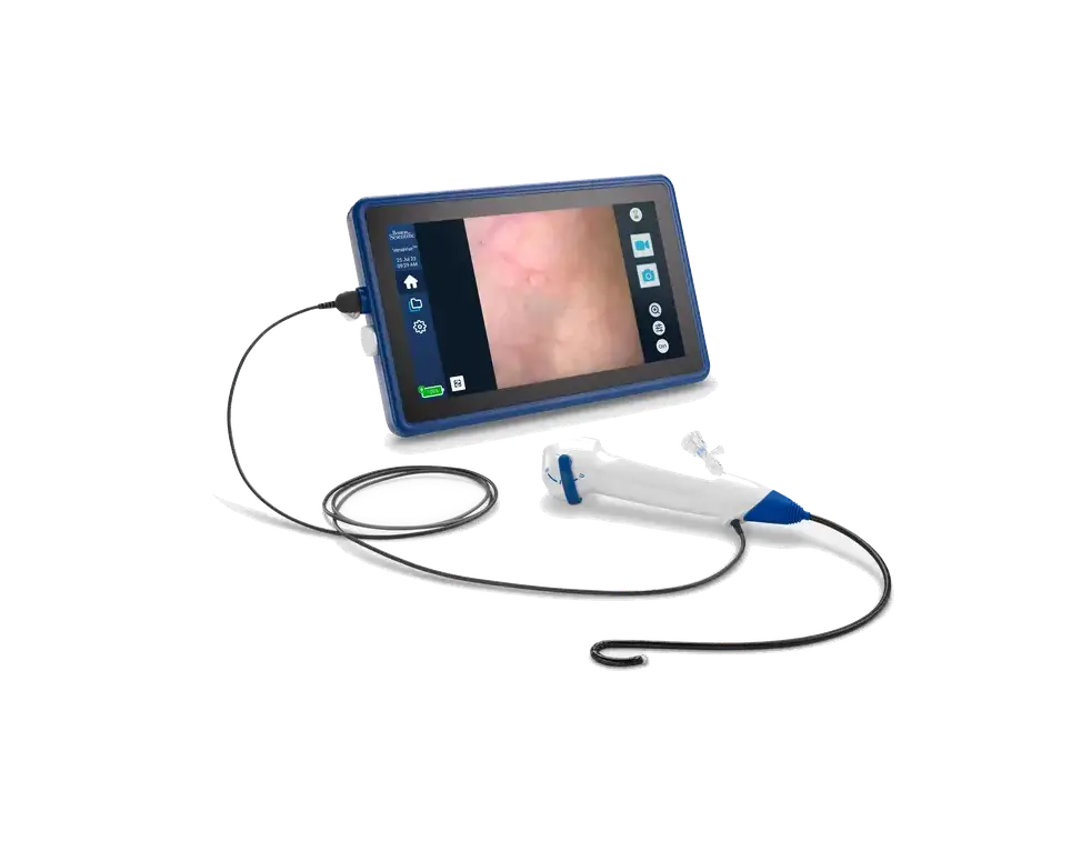 VersaVue Single-Use Flexible Cystoscope